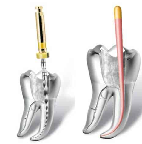 uploads/categories/1697330620_Endodontics.PNG